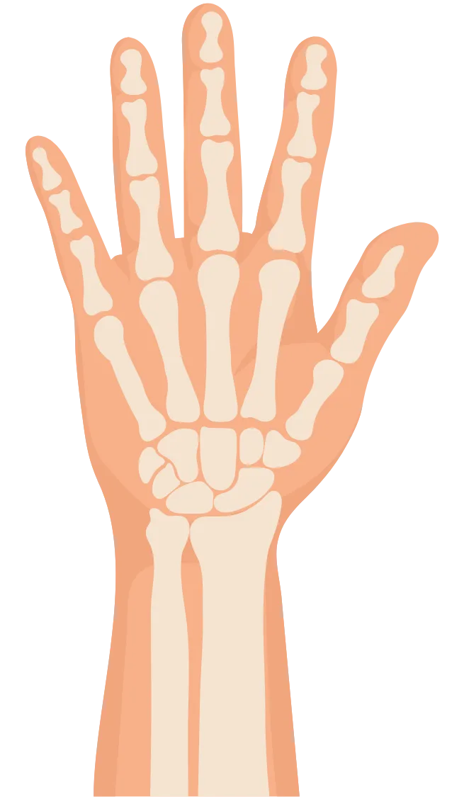 Arm and Hand Surgeon in Dubai