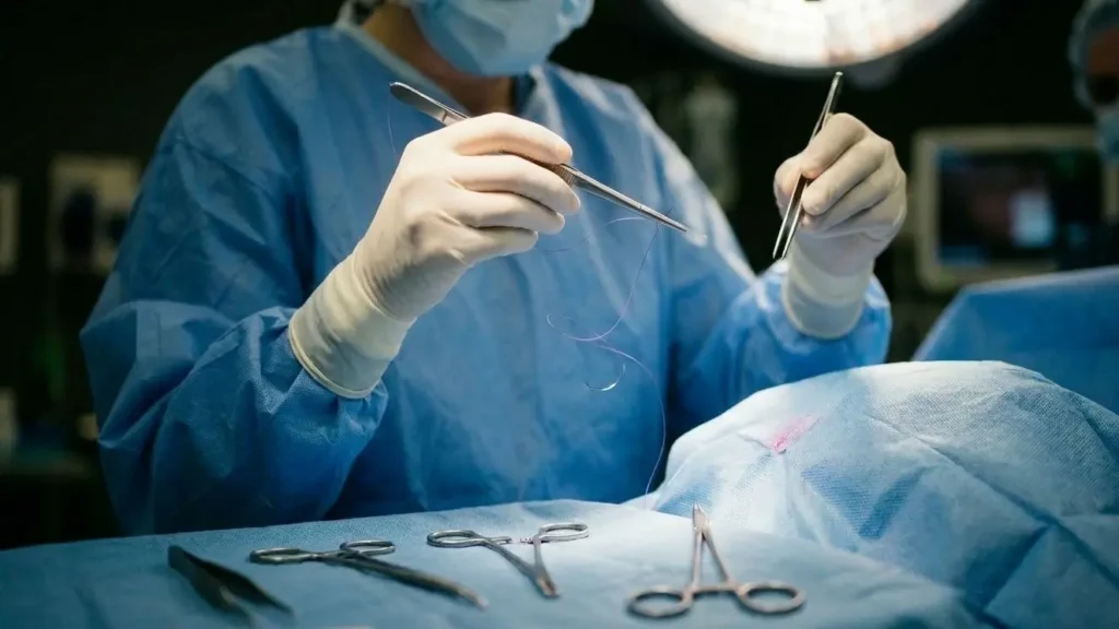 Finger Plastic Surgery