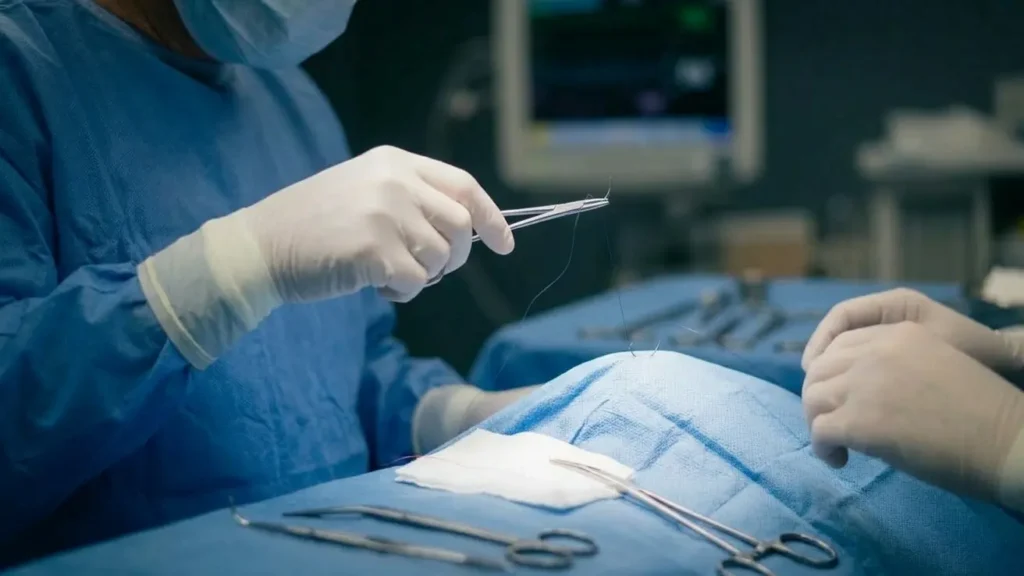 What is Finger Plastic Surgery