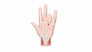 Mallet Finger Splint: Expert Guide to Healing & Recovery in Dubai