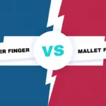 Mallet Finger vs Trigger Finger: Most important differences.