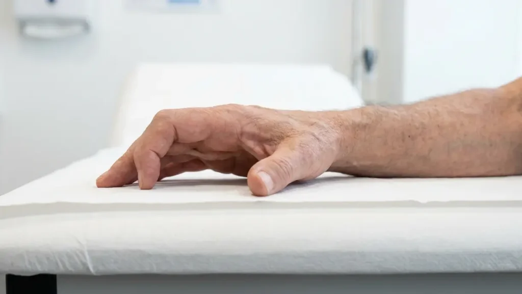 How Do I Tell Dupuytren's Contracture vs Trigger Finger