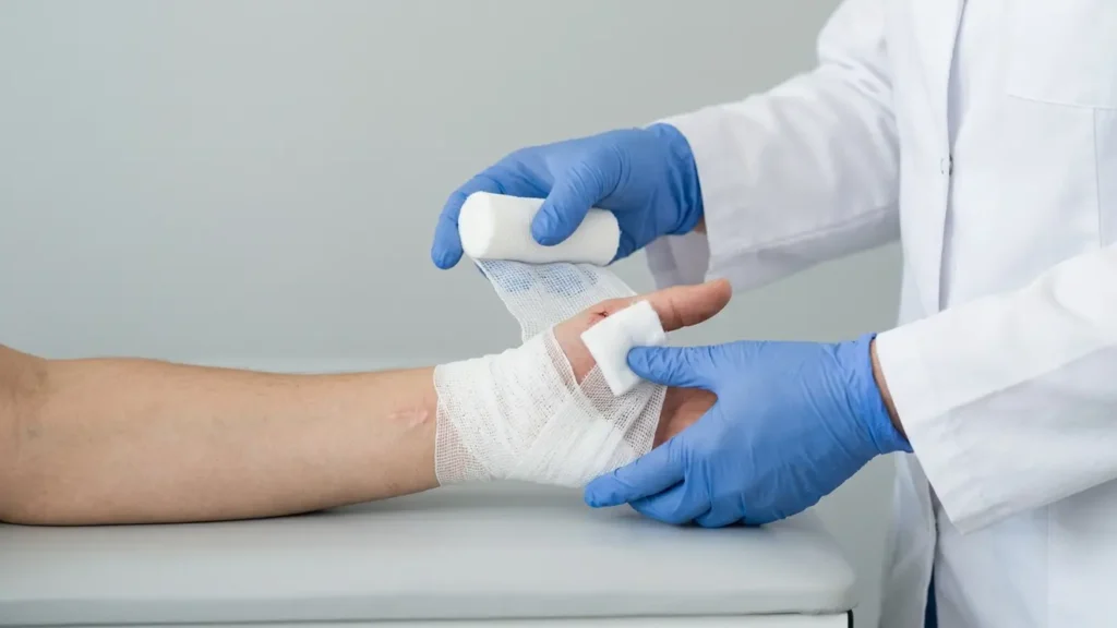 ganglion cyst recovery time