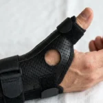 Skier’s Thumb Treatment: Splinting, Exercises & Surgery