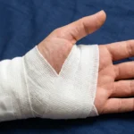Swelling After Wrist Surgery: What’s Normal & When to Worry