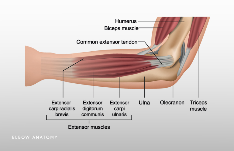 Wrist Tendinopathy