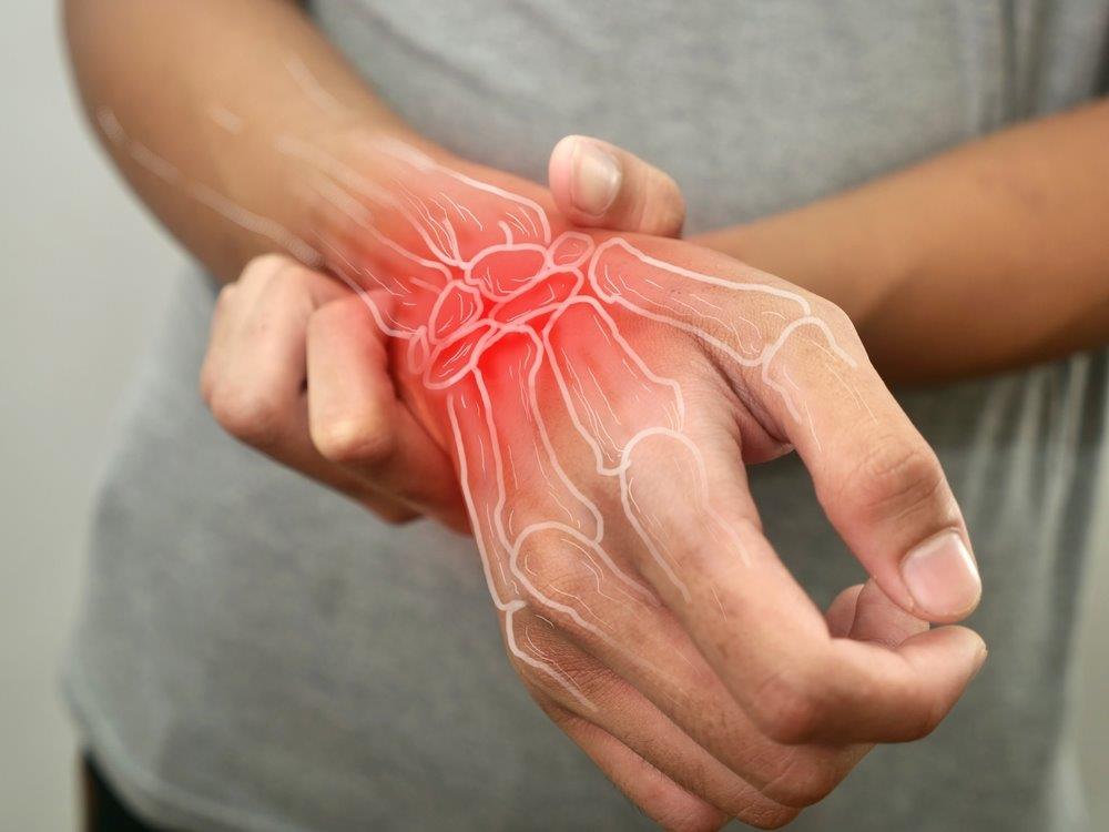 Persistent Symptoms After a Wrist Sprain
