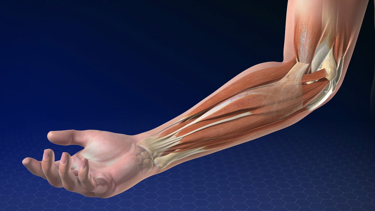 Ganglion Cyst