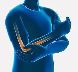 Post-Traumatic Stiffness