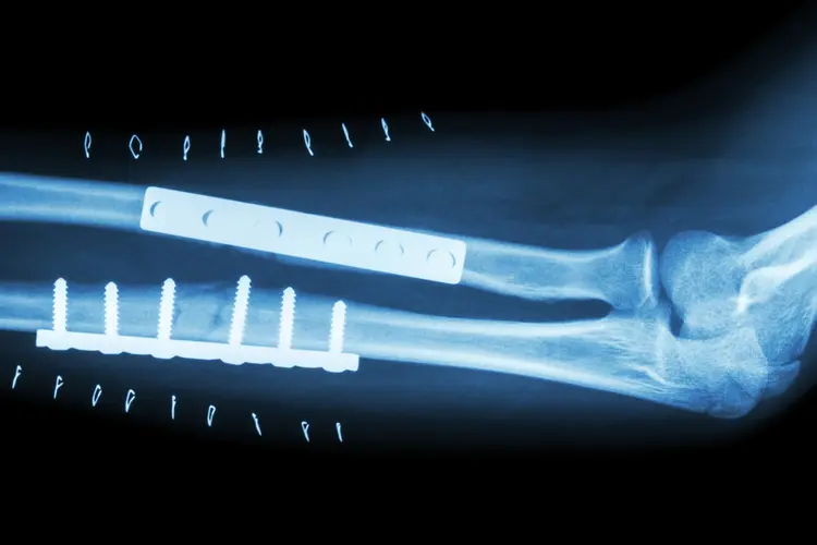 Systemic medical conditions