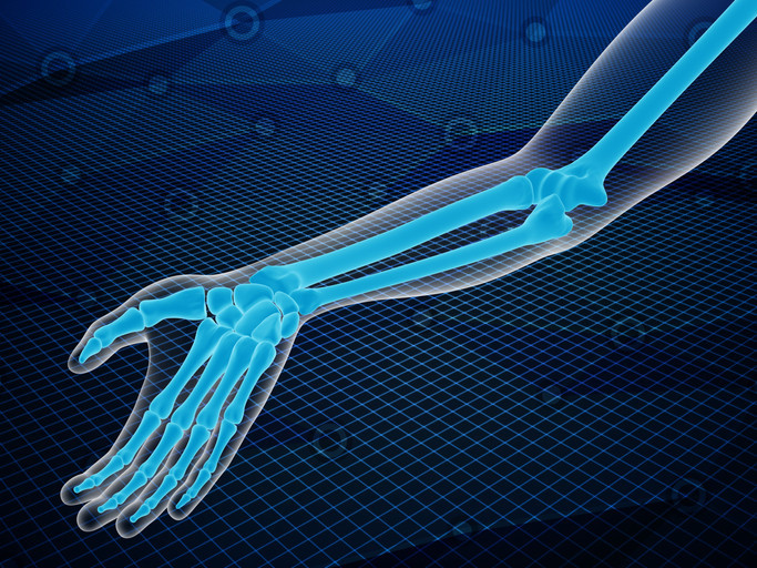 Malunion wrist fracture