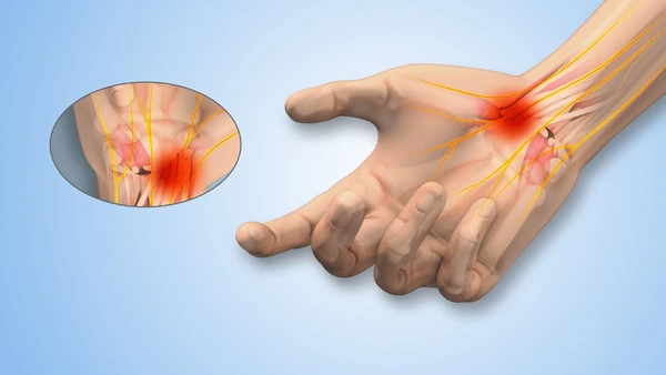 Fellowship-Trained in Hand & Upper Limb Surgery