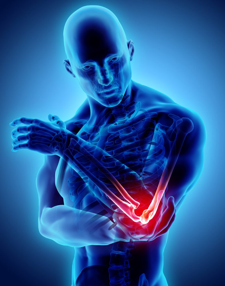 Specialist surgical team preparing for upper limb surgery