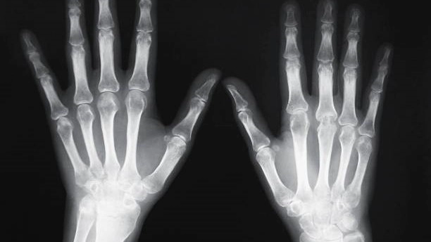 ulnar wrist pain treatment​
