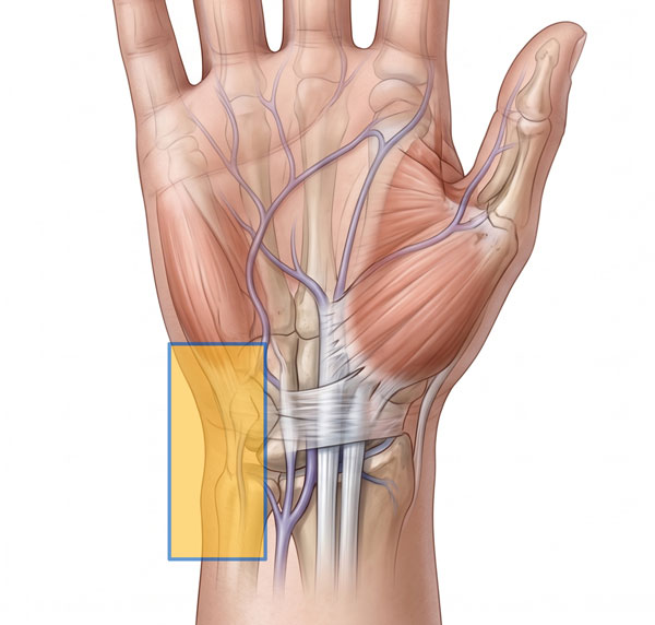 Ulnar-sided wrist pain localization