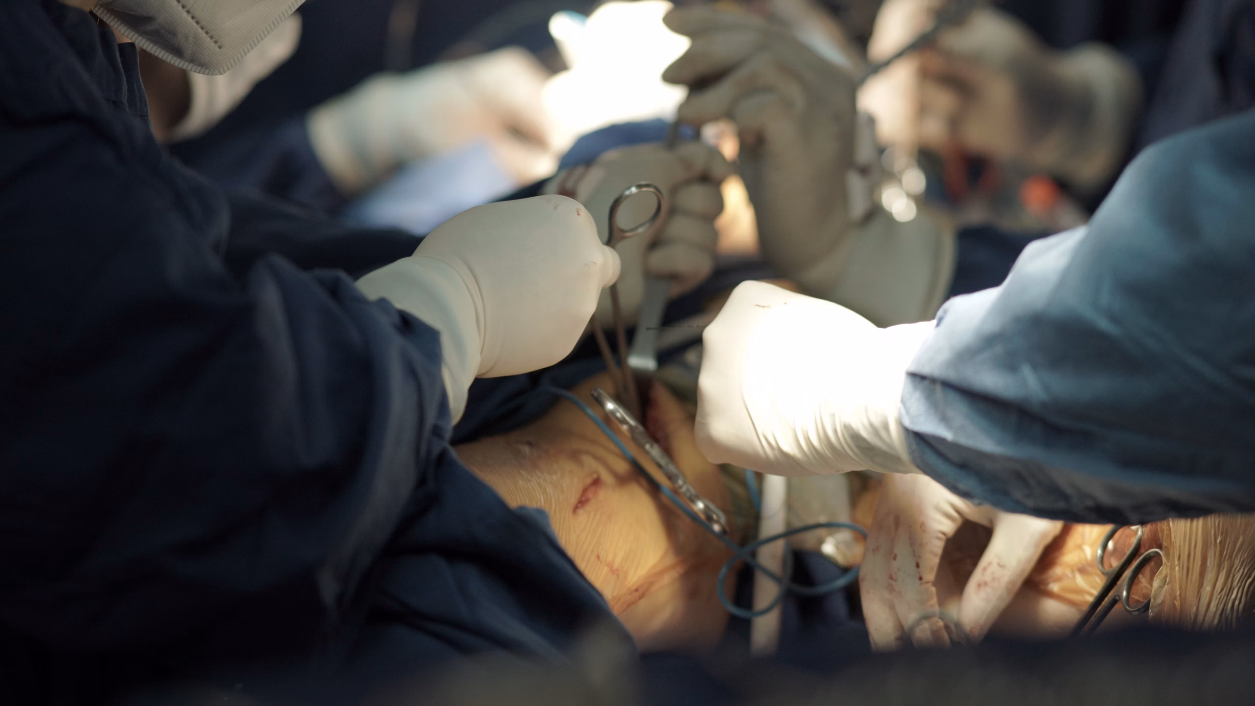 Precise tendon reconstruction surgery