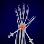 Average Forearm Size: Ideal Baselines & Joint Health Tips