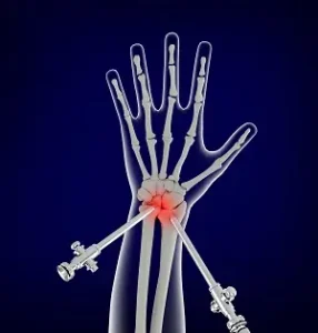Average Forearm Size