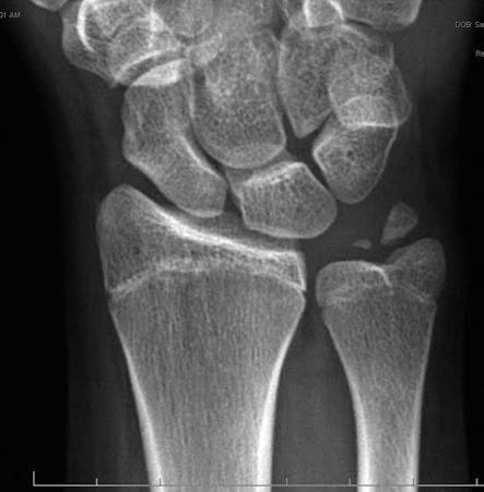 DRUJ Instability