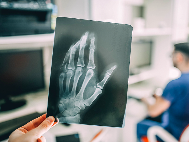 Medical professional reviewing a hand X-ray