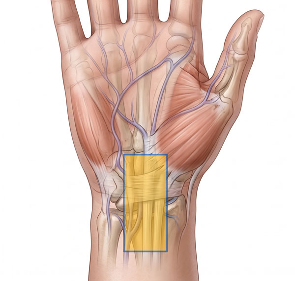 Wrist Stiffness Evaluation